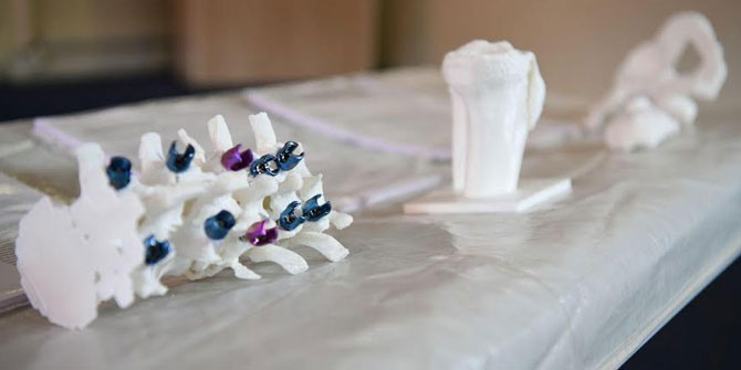 EÜ’de ortopedik tedavide yeni bir model geliştirildi