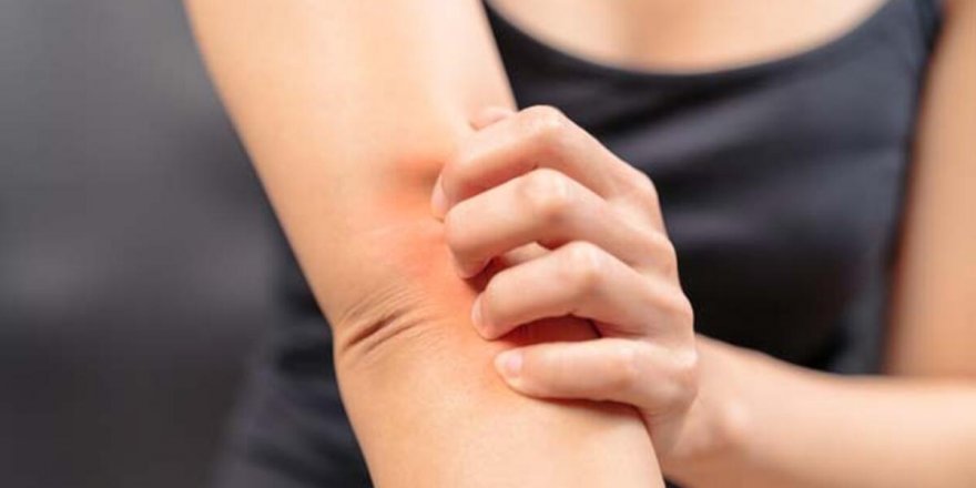 Uzmanı açıkladı! Yanlış beslenme, cilt hastalıklarını tetikliyor…