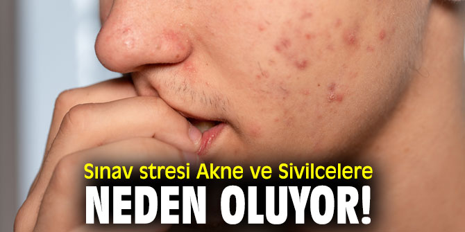 Uzmanı açıkladı! Sınav stresi...