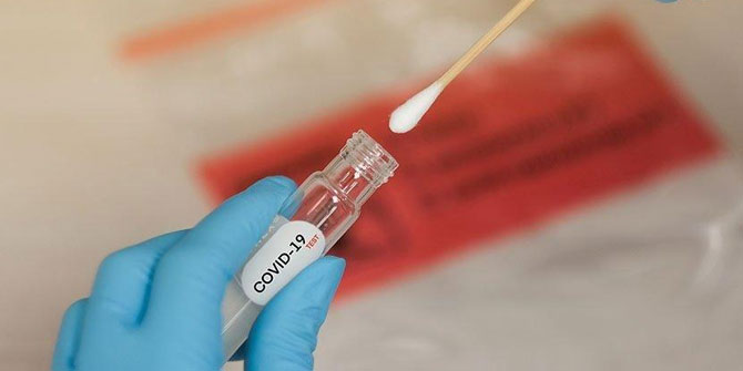 Firmalara EBSO'dan Covid-19 antikor testi!