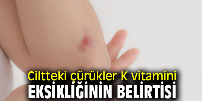 K vitamini eksikliğine dikkat!