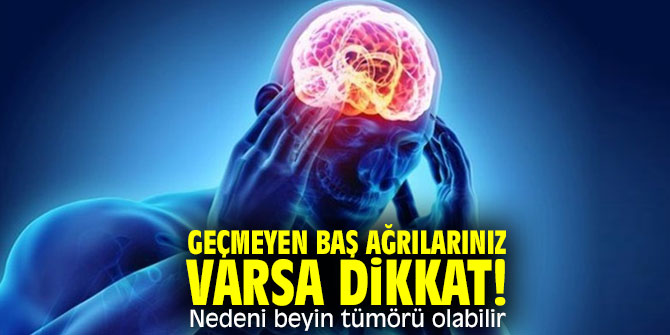 Geçmeyen baş ağrılarınız varsa dikkat! Nedeni beyin tümörü olabilir