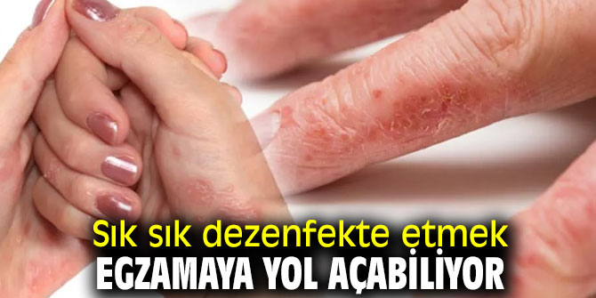 Elleri tahrişten korumanın beş yolu!