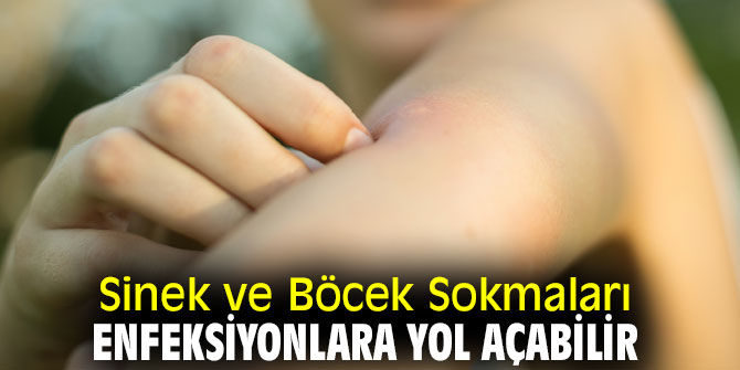 Uzmanı uyardı! Sinek ve Böcek Sokmaları Enfeksiyonlara Yol Açabilir
