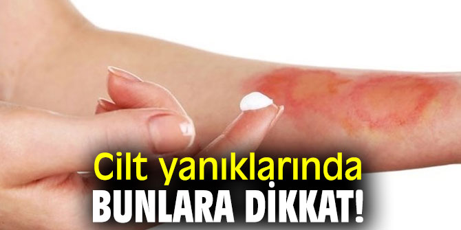 Uzmanı uyardı! Cilt yanıklarında bunlara dikkat!