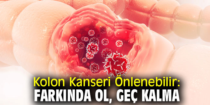 Dikkat! Kolon Kanseri Önlenebilir: Farkında Ol, Geç Kalma 
