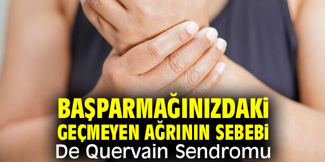 De Quervain Sendromu'na dikkat!