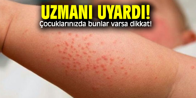 Aman dikkat! Çocuklarınızda bunlar varsa...