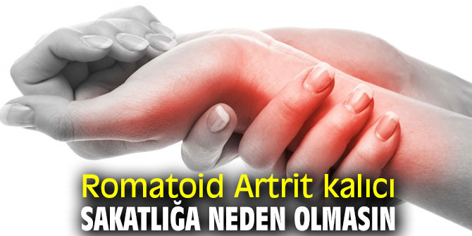 Dikkat! Romatoid Artrit kalıcı sakatlığa neden olmasın!