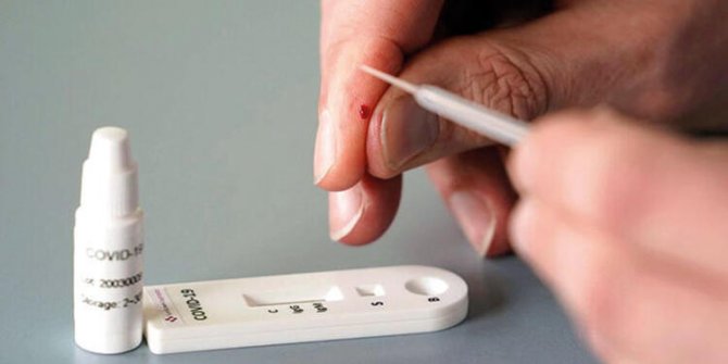 EBSO’nun Covid-19 antikor testi uygulaması sürüyor!