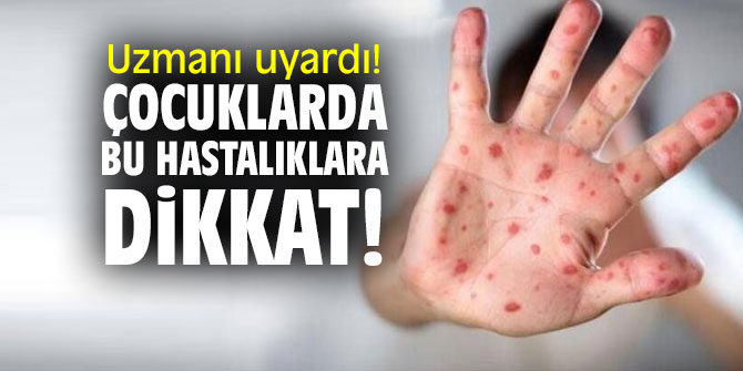 Dikkat! Çocuklarda  el, ayak ve ağız hastalıkları...