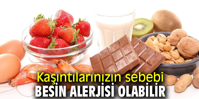 Uzmanı uyardı! Kaşıntılarınızın sebebi besin alerjisi olabilir