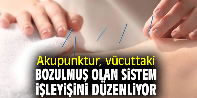 Akupunktur, vücuttaki bozulmuş olan sistem işleyişini düzenliyor