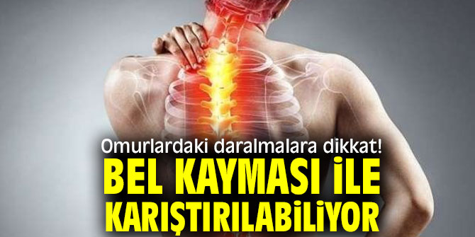 Uzmanı uyardı! Omurlardaki daralmalara dikkat...