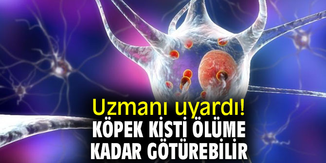 Uzmanı uyardı! "Köpek kisti ölüme kadar götürebilir”