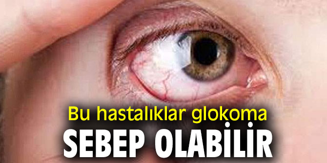 Bu hastalıklar glokoma sebep olabilir