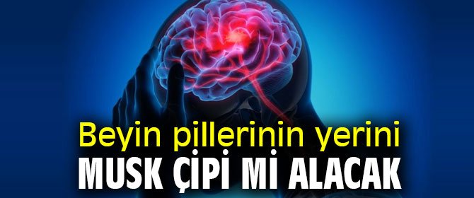 Beyin pillerinin yerini Musk çipi mi alacak!