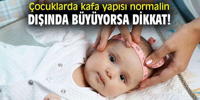Çocuklarda kafa yapısı normalin dışında büyüyorsa dikkat!