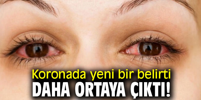 Koronavirüste 'kırmızı göz' ihtimali! 