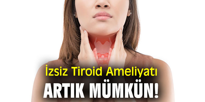 İzsiz Tiroid Ameliyatı artık mümkün!