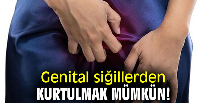 Genital siğillerden kurtulmak mümkün!