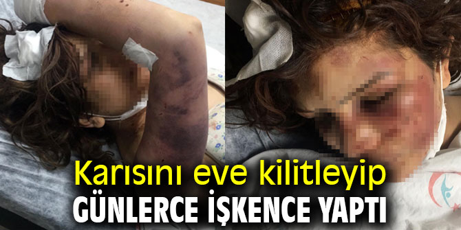 Şanlıurfa'da işkenceci koca dehşeti!