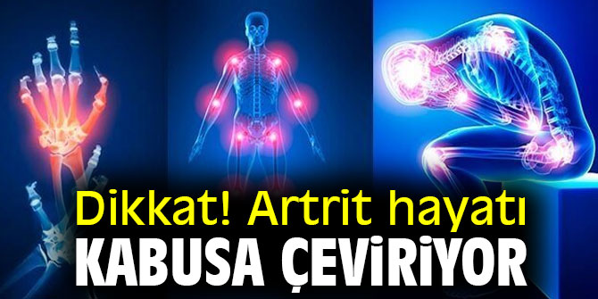 Dikkat! Artrit hayatı kabusa çeviriyor