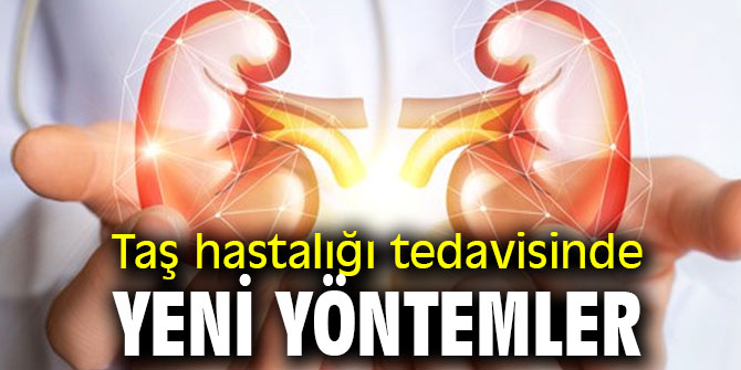 Taş hastalığı tedavisinde yeni yöntemler