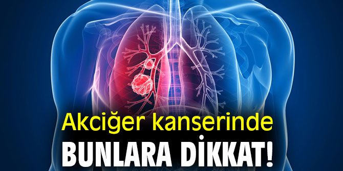 Akciğer kanserinde bunlara dikkat!