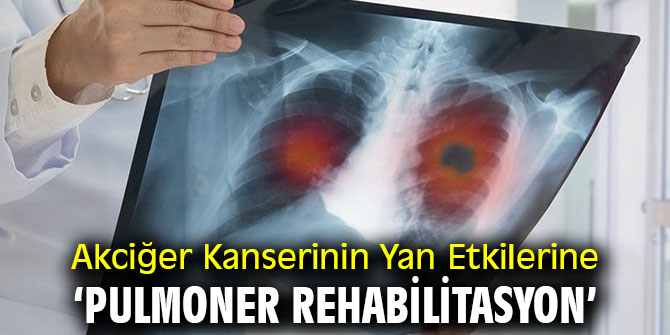 Akciğer Kanserinin Yan Etkilerine karşı ‘Pulmoner Rehabilitasyon’