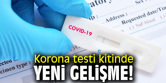 Korona testi kitinde yeni gelişme!