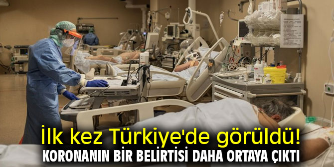 Koronavirüsün bir belirtisi daha ortaya çıktı