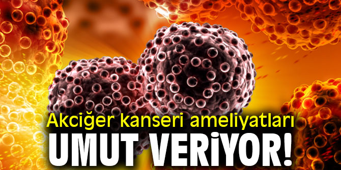 Akciğer kanseri ameliyatları umut veriyor!