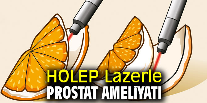 Prostat ameliyatında yeni yöntem! 