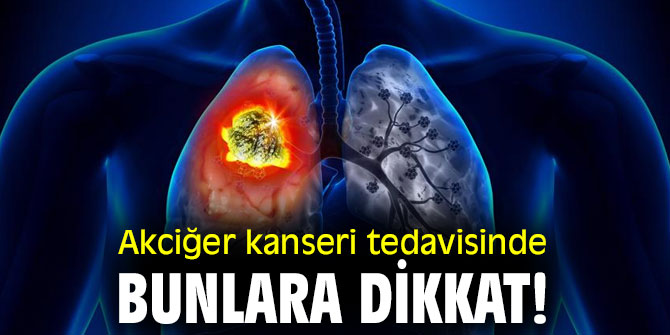 Akciğer Kanseri tedavisinde bunlara dikkat!