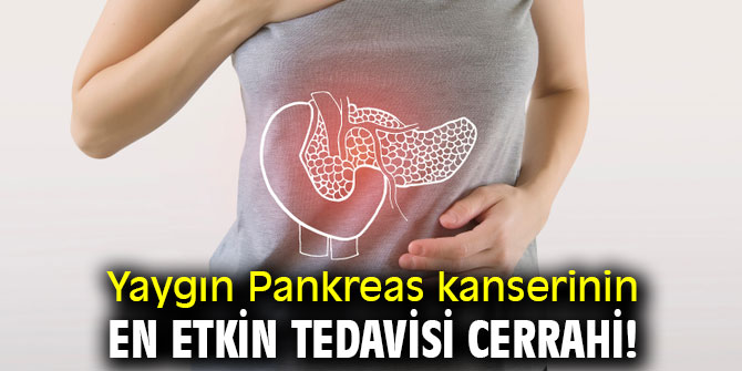 Uzmanı uyardı! Pankreas kanserinin en etkin tedavisi cerrahi!
