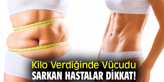 Kilo Verdiğinde Vücudu Sarkan Hastalar dikkat!