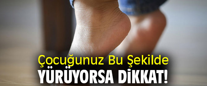 Uzmanı uyardı! Çocuğunuz Bu Şekilde Yürüyorsa Dikkat!
