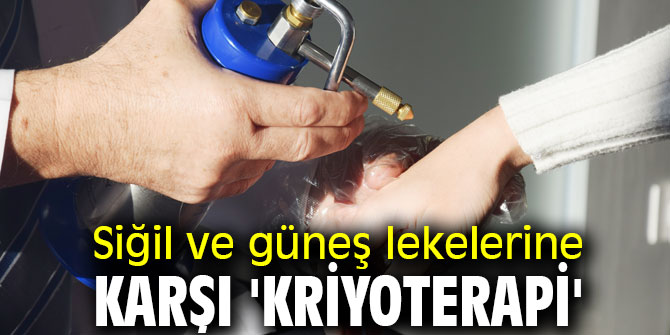 Siğil ve güneş lekelerine karşı yeni yöntem!