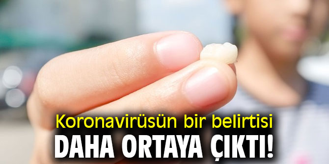 Uzmanlar uyarıyor! Koronavirüsün bir belirtisi daha ortaya çıktı!