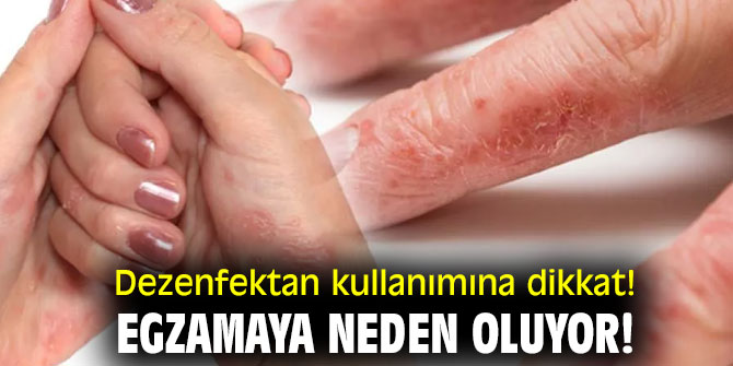 Dezenfektan kullanımına dikkat! Egzamaya neden oluyor!