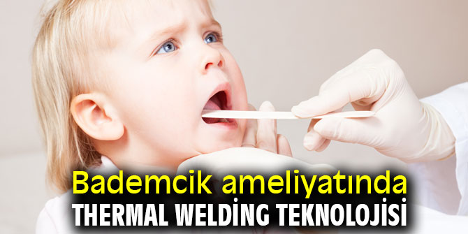 Bademcik ameliyatında Thermal Welding teknolojisi