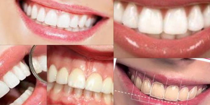 KUSURSUZ GÜLÜMSEMENİN ŞİFRESİ