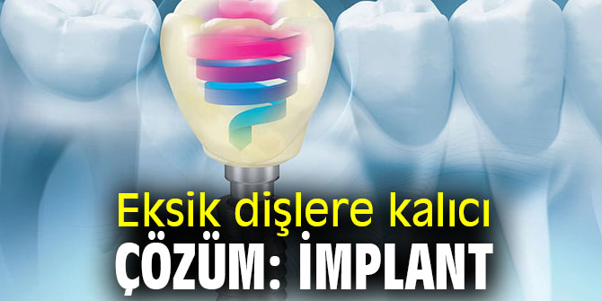 Eksik dişlere kalıcı çözüm mümkün