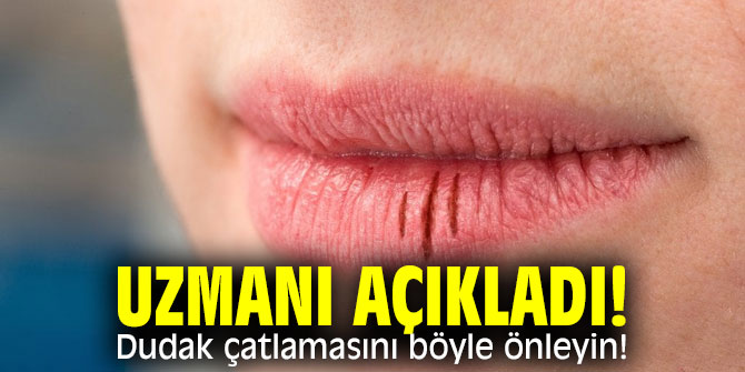 Dudak çatlamasını önlemek için bunları yapın