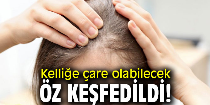 Kelliğe çare olabilecek öz keşfedildi! 