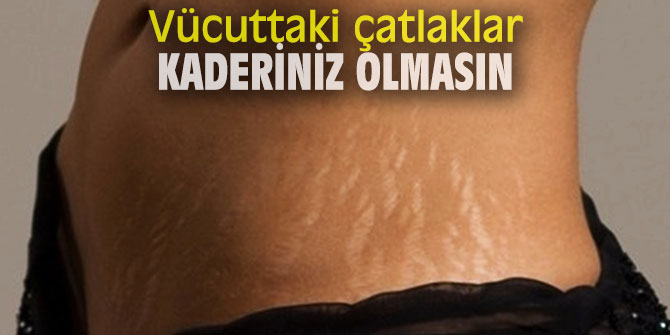 Uzmanı açıkladı! Vücuttaki çatlaklar kaderiniz değil!