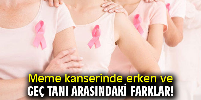 Meme kanserinde erken ve geç tanı arasındaki farklar!