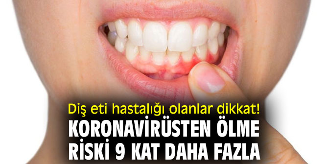 Diş eti hastalığı olanlar dikkat! Koronavirüsten ölme riski 9 kat daha fazla
