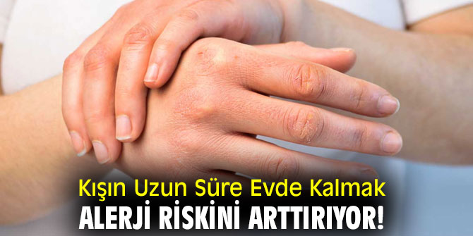 Kışın Uzun Süre Evde Kalmak Alerji Riskini Arttırıyor!